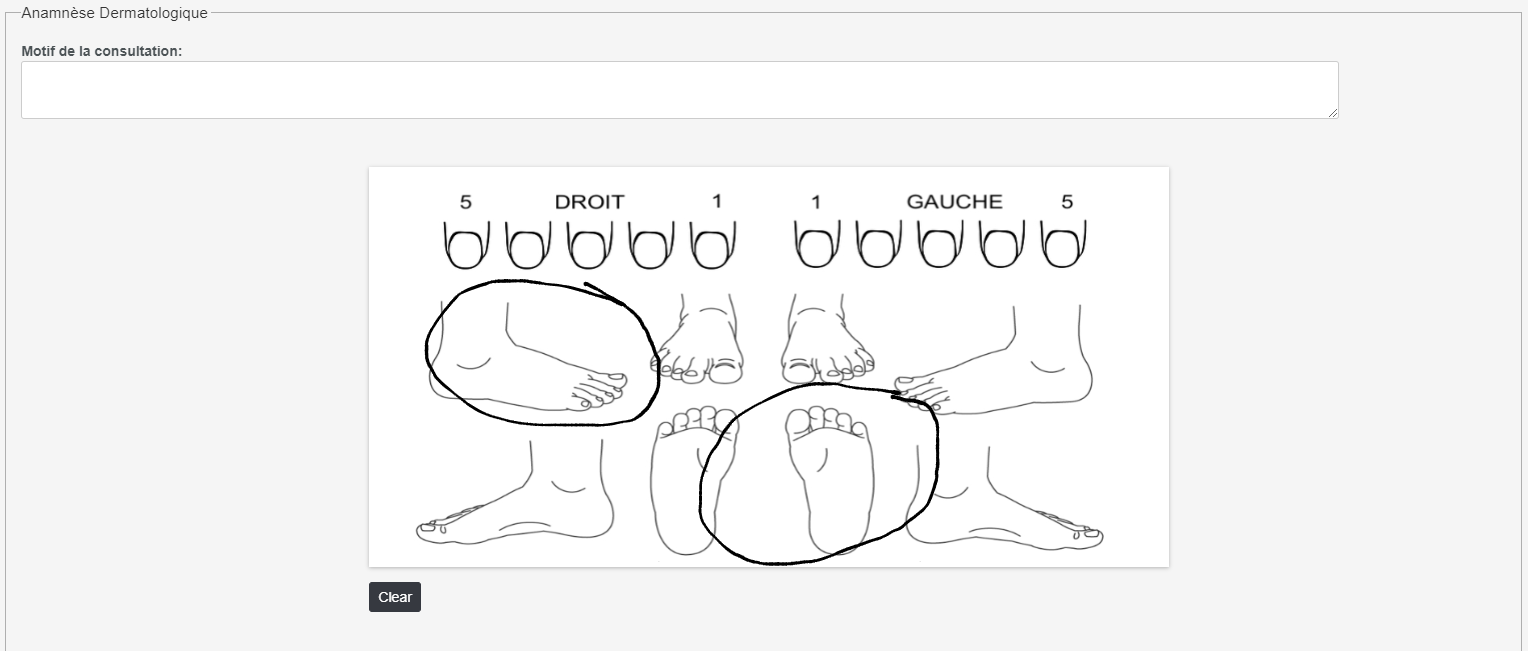 PiedEncercle.png PiedEncercle.png